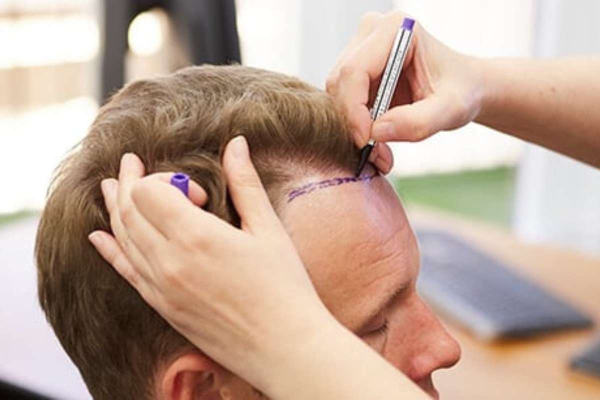 Spencer Stevenson Hair Restoration | Spexhair | The Enterprise World