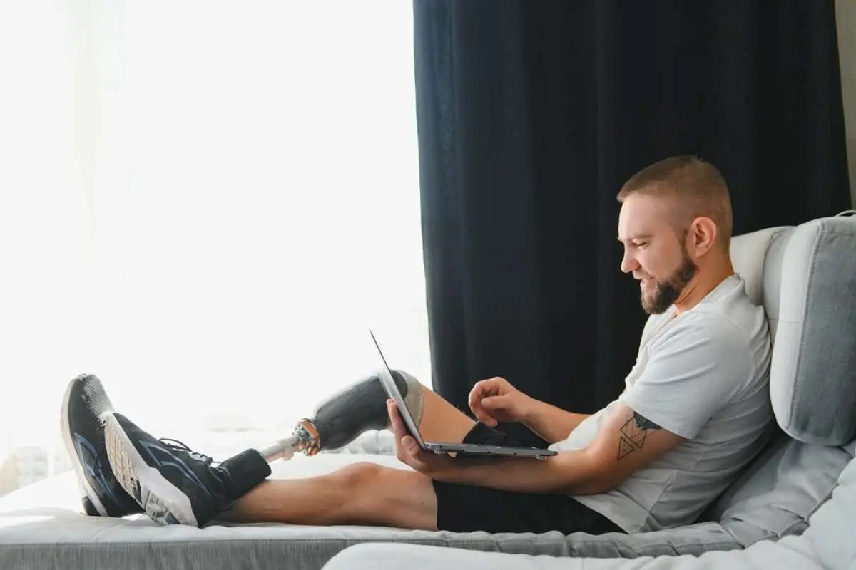 Above-Knee Amputation Recovery Timeline: What to Expect | The Enterprise World