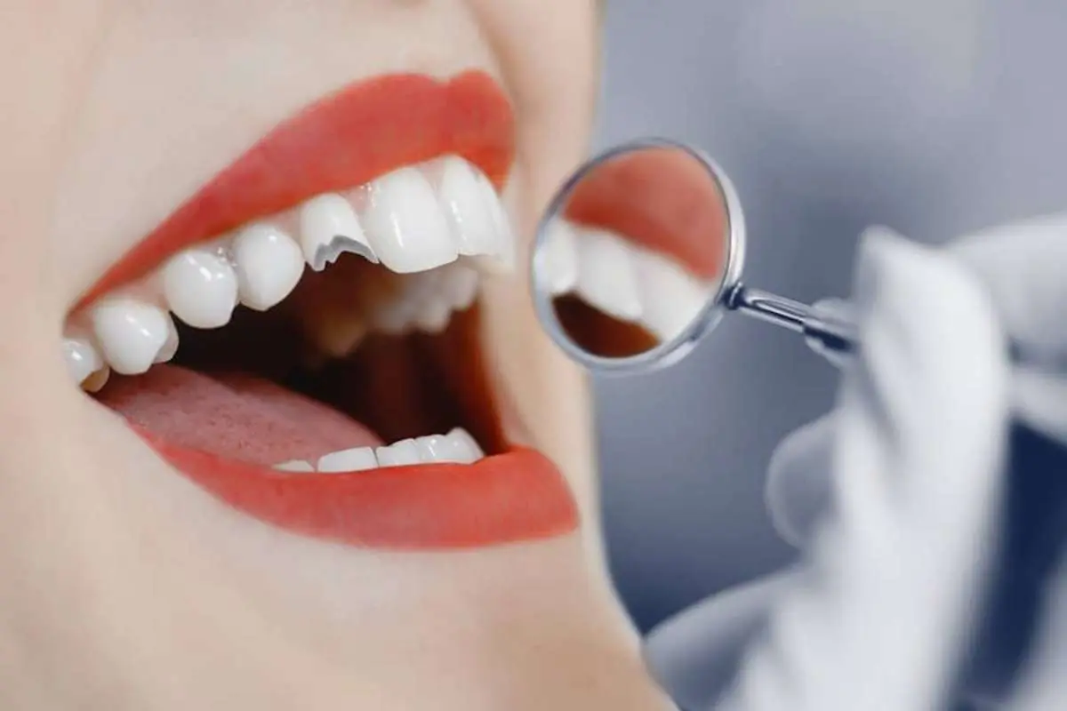 Teeth are Crumbling? Causes & Solutions | The Enterprise World