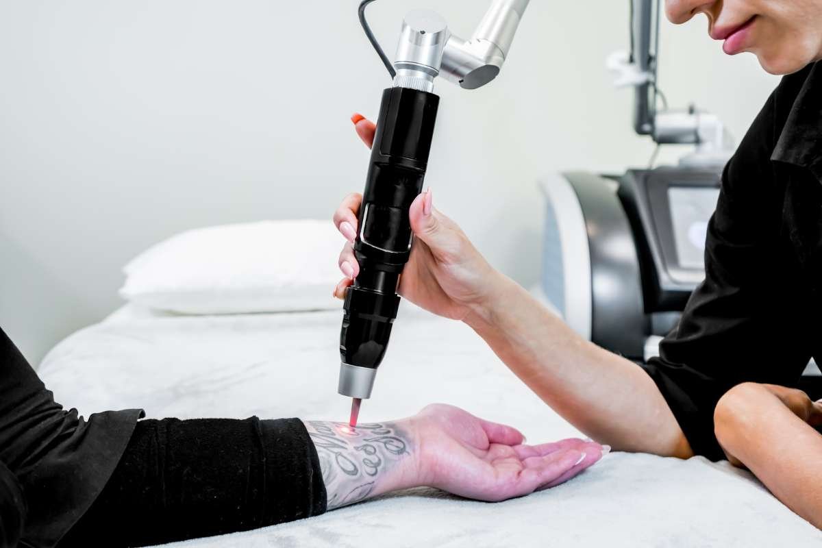 How Laser Tattoo Removal Technology Transforming? | The Enterprise World