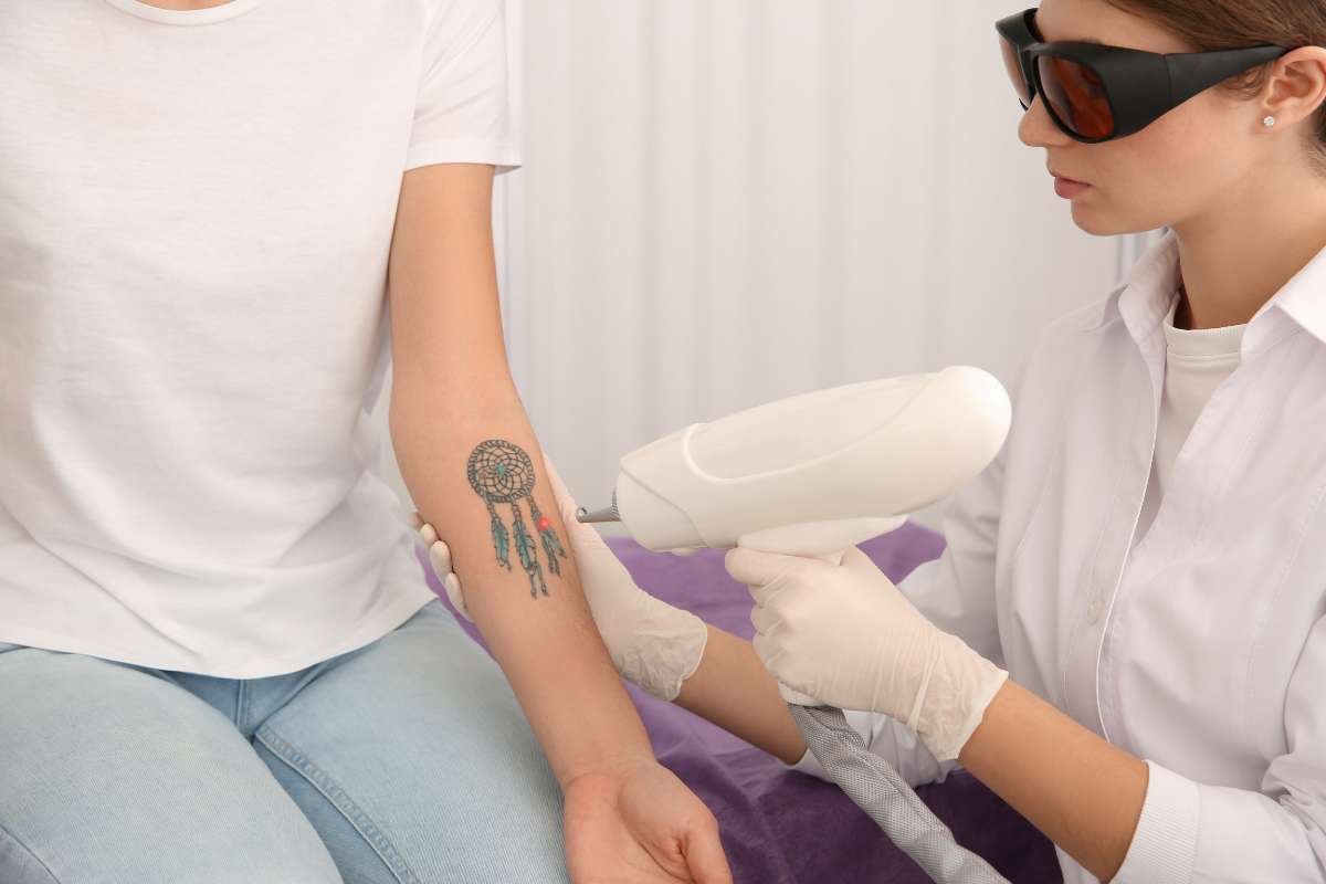 How Laser Tattoo Removal Technology Transforming? | The Enterprise World