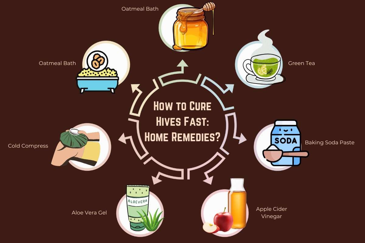 How to Cure Hives Fast? 7 Home Remedies | The Enterprise World 