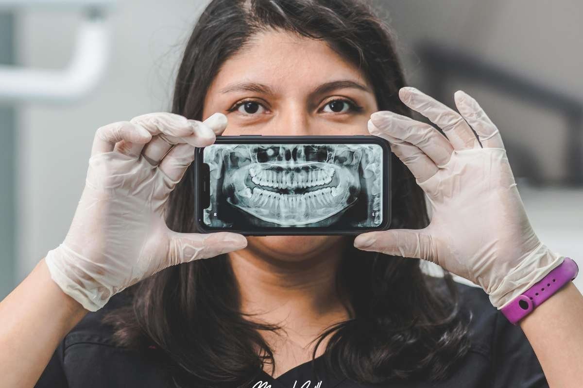 Are All-on-4 Dental Implants Worth It? Key Decision Factors | The Enterprise World