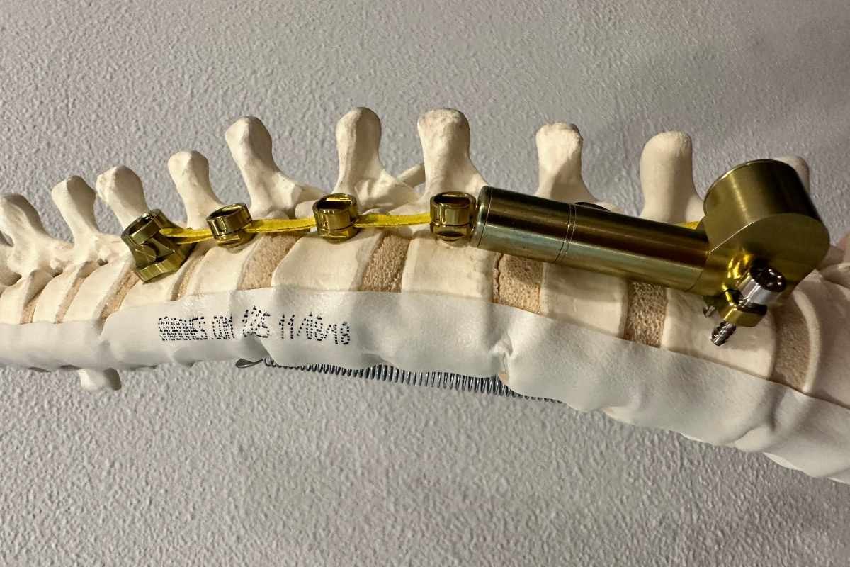 Auctus Surgical: John Ashley’s Bold Bet - Rewriting the $2B Scoliosis Market | The Enterprise World
