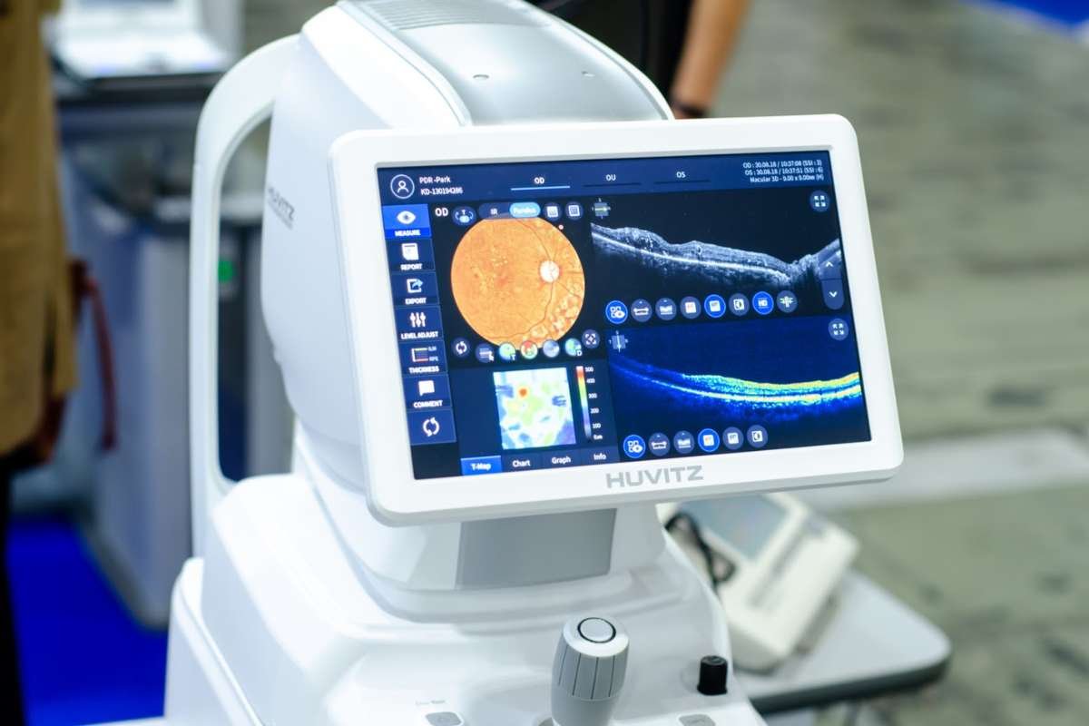 What Businesses Need to Know About OCT Machines? | The Enterprise World