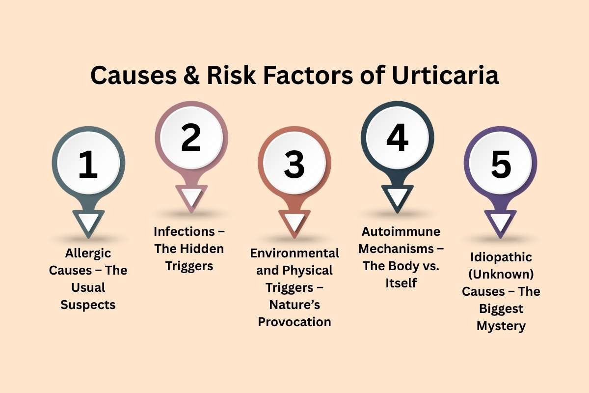 How to Cure Urticaria Permanently? Types, Symptoms & Diagnosis | The Enterprise World 