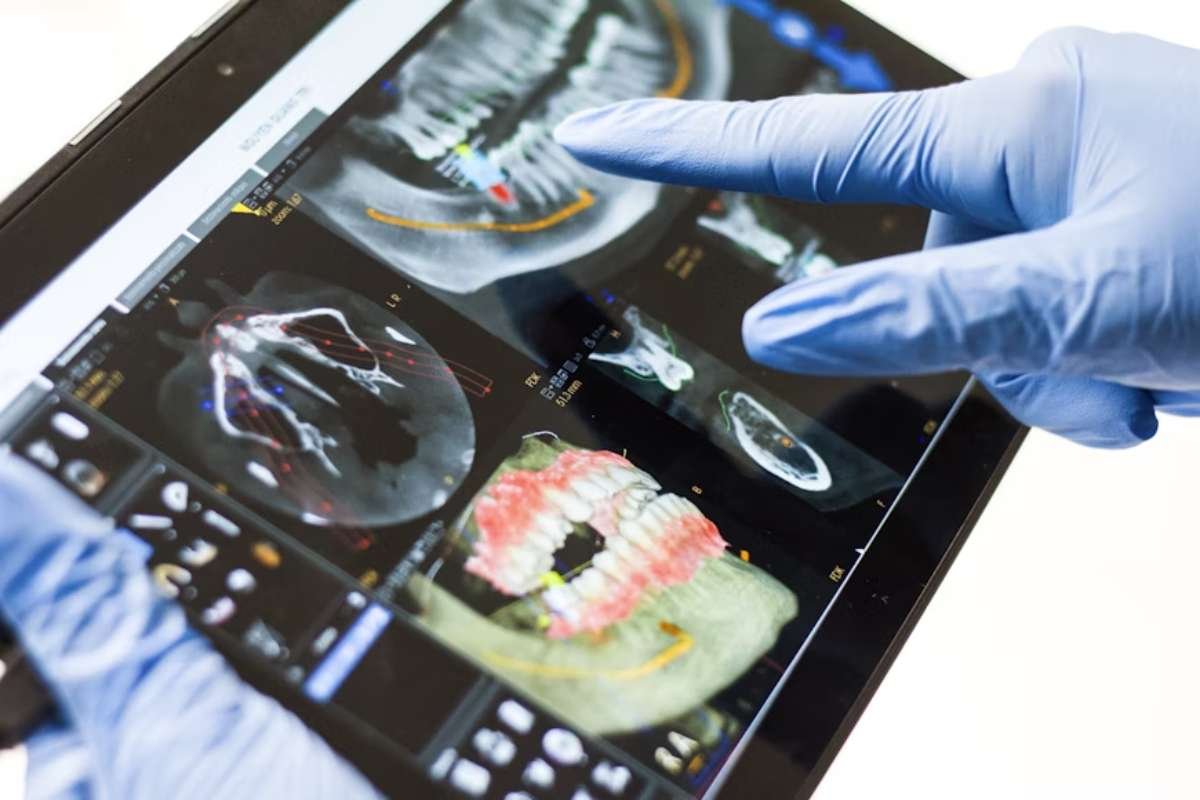 Improving Your Businesses Implant Dentistry Skills Through Continuous Education