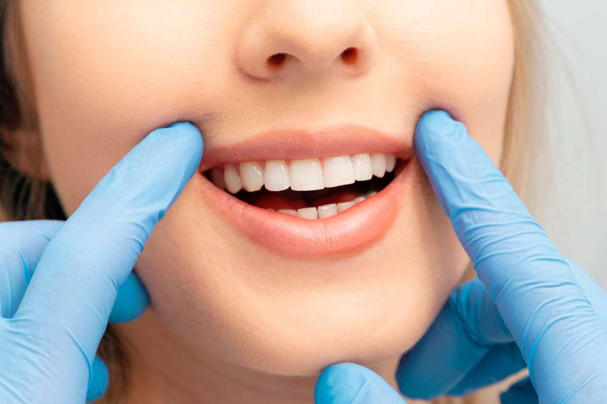 Which Teeth Whitening Upsells Convert Best for Dentists | The Enterprise World