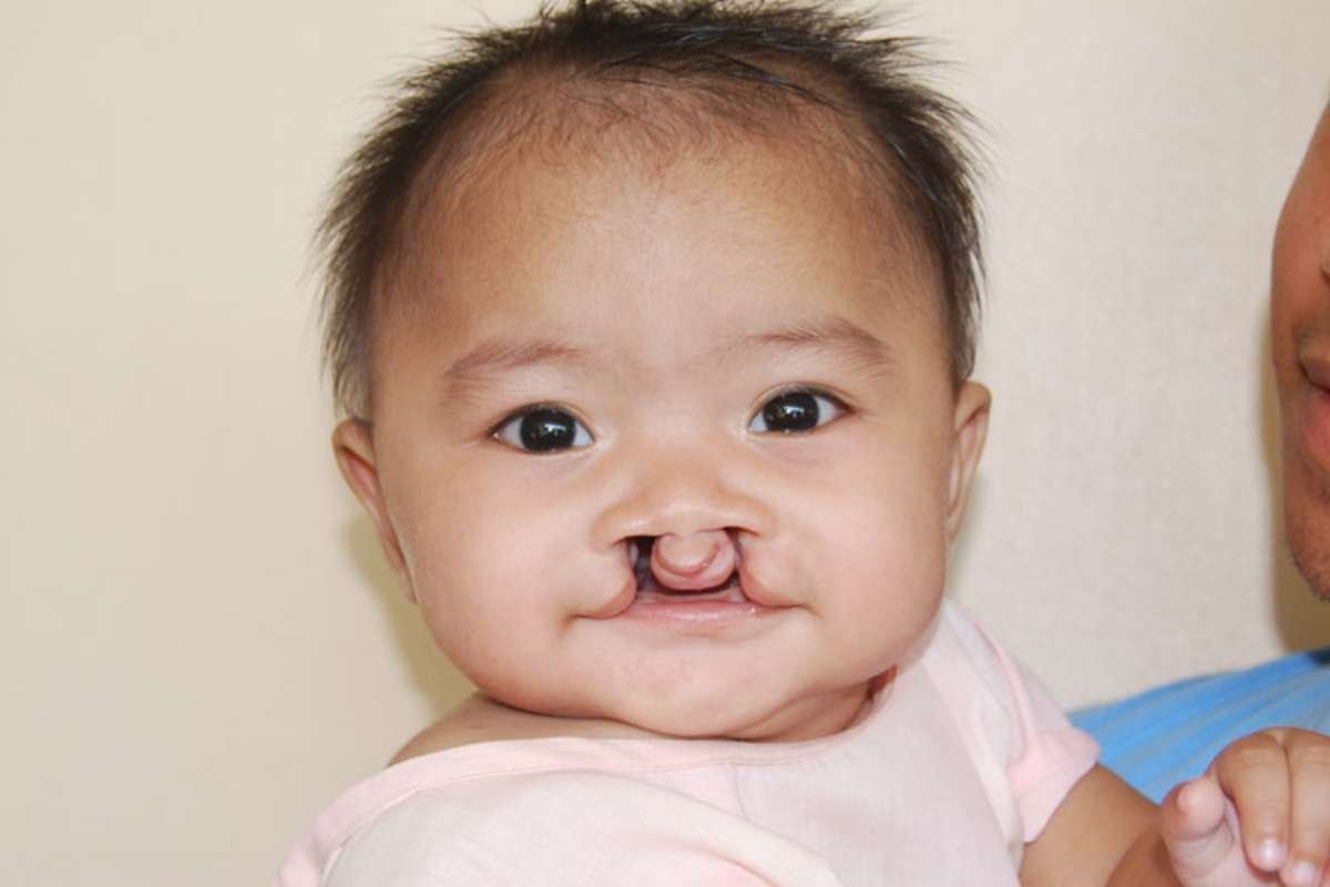 Madame E - Cleft-Craniofacial Advocate | The Faisal Foundation | The Enterprise World
