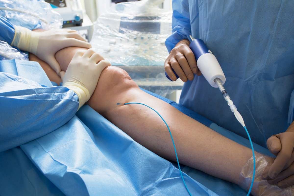 Vein Treatment Specialist in New Jersey for Modern Care | The Enterprise World