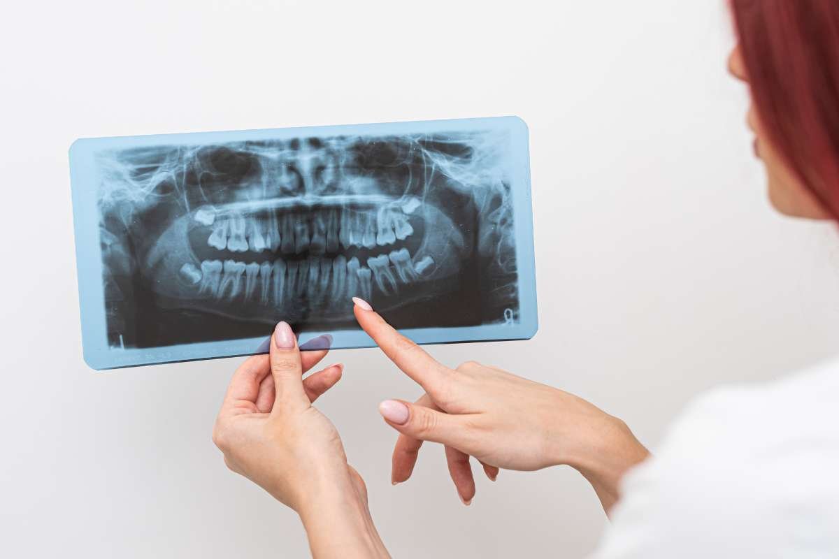 Understanding Dental Implants in Allen: Step-by-Step Guide | The Enterprise World