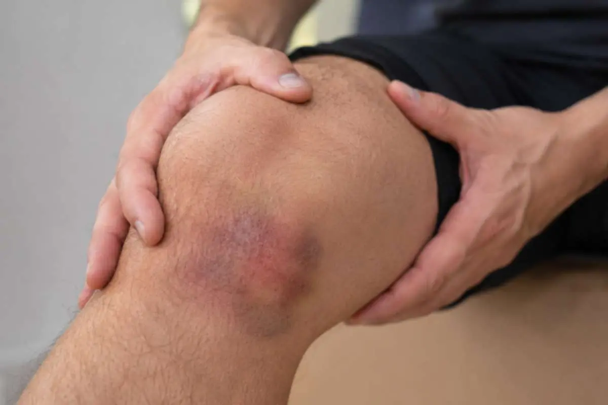 Delayed Symptoms After a Car Accident: What to Know | The Enterprise World