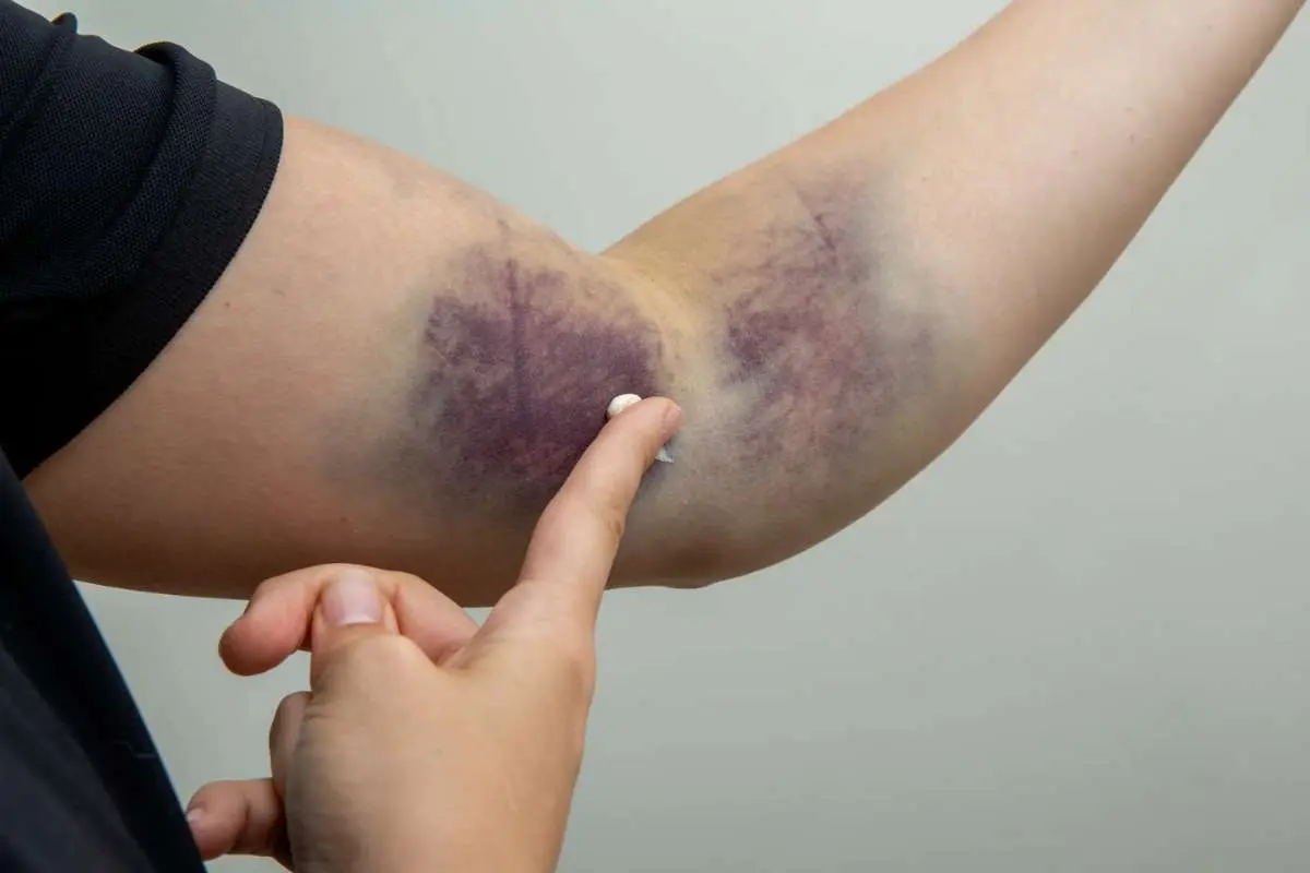 Delayed Symptoms After a Car Accident: What to Know | The Enterprise World